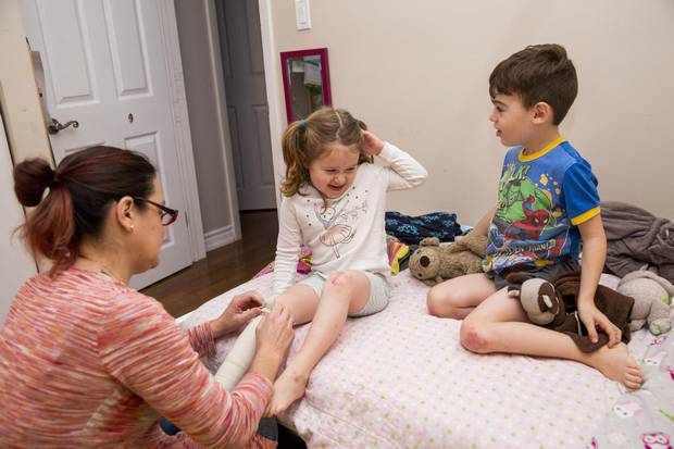Heidi Graf, adjusts a bandage on her daughter, Malia, 4, as her brother Maxwell, 6, looks on at their Pickering, Ont., home on Dec. 1. The children have a rare genetic skin condition that results in huge blisters and open wounds.