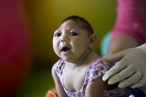 Two-month-old Lara is monitored in the microcephaly unit of a Paraiba hospital. Brazil’s Ministry of Heath has cataloged approximately 580 babies with severe brain damage related to the Zika virus.