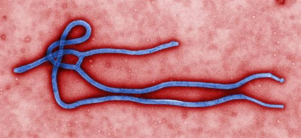 The Ebola virus, shown in an undated handout from the U.S. Centers for Disease Control.