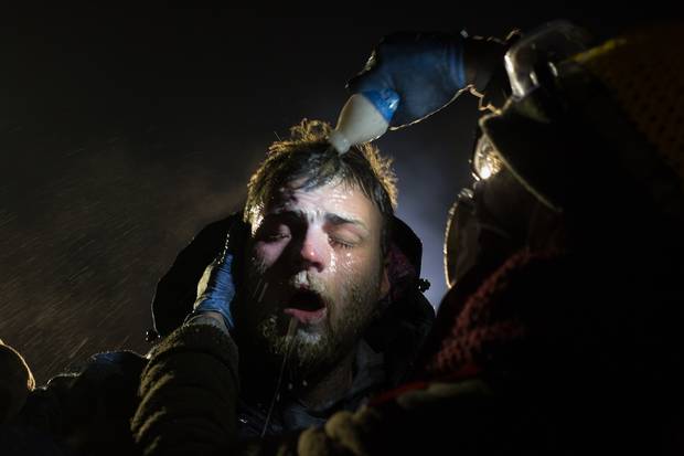 A man is treated with milk of magnesia after being pepper-sprayed at a police blockade on Highway 1806, near Cannon Ball.