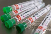 FILE PHOTO: Test tubes labelled "Monkeypox virus positive" are seen in this illustration taken May 22, 2022. REUTERS/Dado Ruvic/Illustration/File Photo