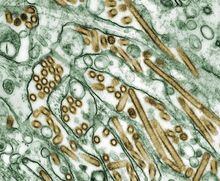 Colorized transmission electron micrograph of Avian influenza A H5N1 viruses (seen in gold) grown in MDCK cells (seen in green) as shown in this undated handout photo. The Toronto Zoo has shut down some of its bird enclosures after a bird flu case was detected at a southern Ontario poultry farm. THE CANADIAN PRESS/HO-CDC/Cynthia Goldsmith via NIH *MANDATORY CREDIT*