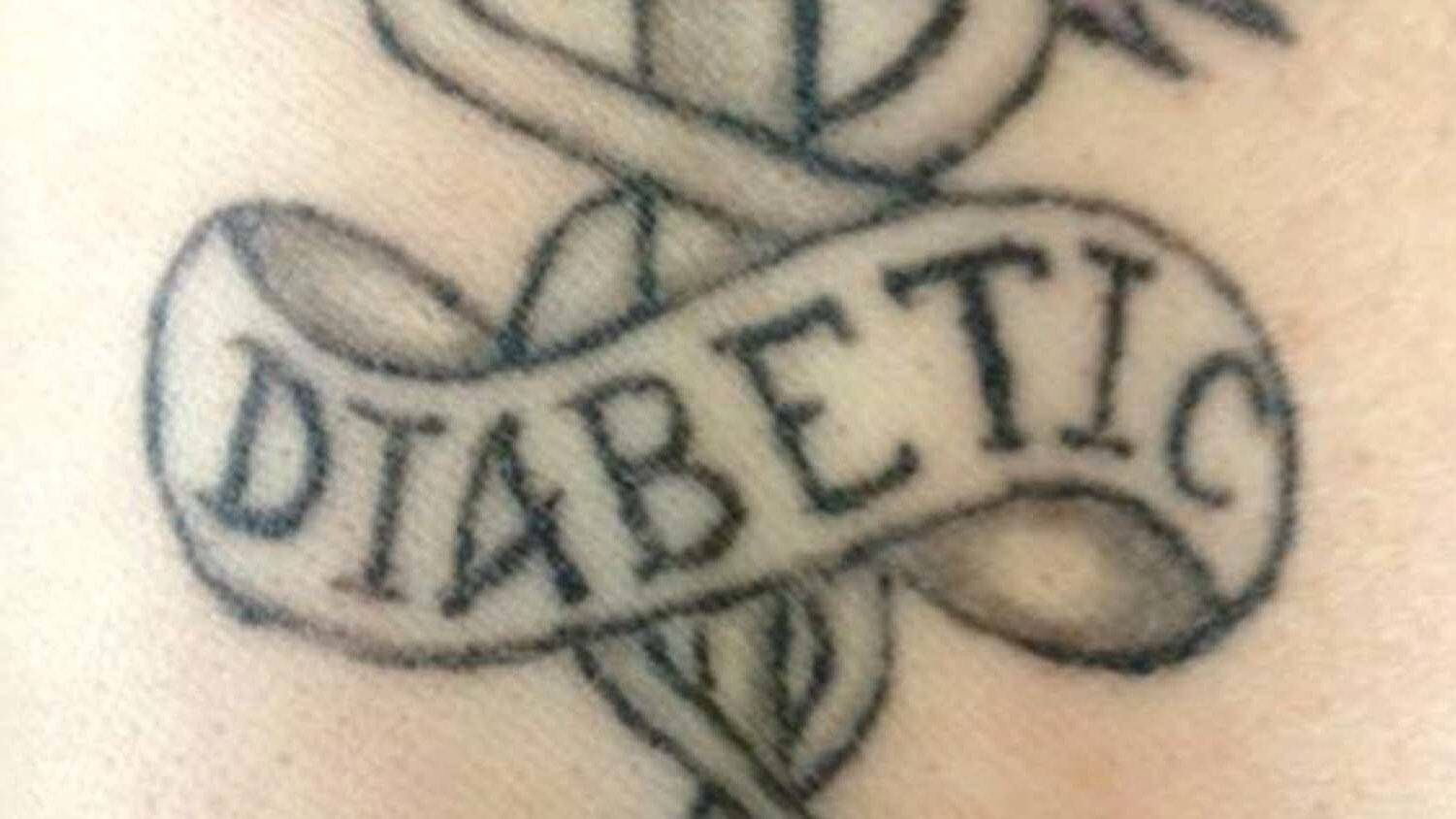 Medical information tattoos raise health-care questions - The Globe and Mail