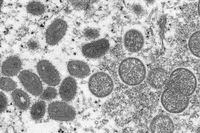 FILE - This 2003 electron microscope image made available by the Centers for Disease Control and Prevention shows mature, oval-shaped monkeypox virions, left, and spherical immature virions, right, obtained from a sample of human skin associated with the 2003 prairie dog outbreak. WHO's top monkeypox expert Dr. Rosamund Lewis said she doesn’t expect the hundreds of cases reported to date to turn into another pandemic, but acknowledged there are still many unknowns about the disease, including how exactly it’s spreading and whether the suspension of mass smallpox immunization decades ago may somehow be speeding its transmission. (Cynthia S. Goldsmith, Russell Regner/CDC via AP, File)
