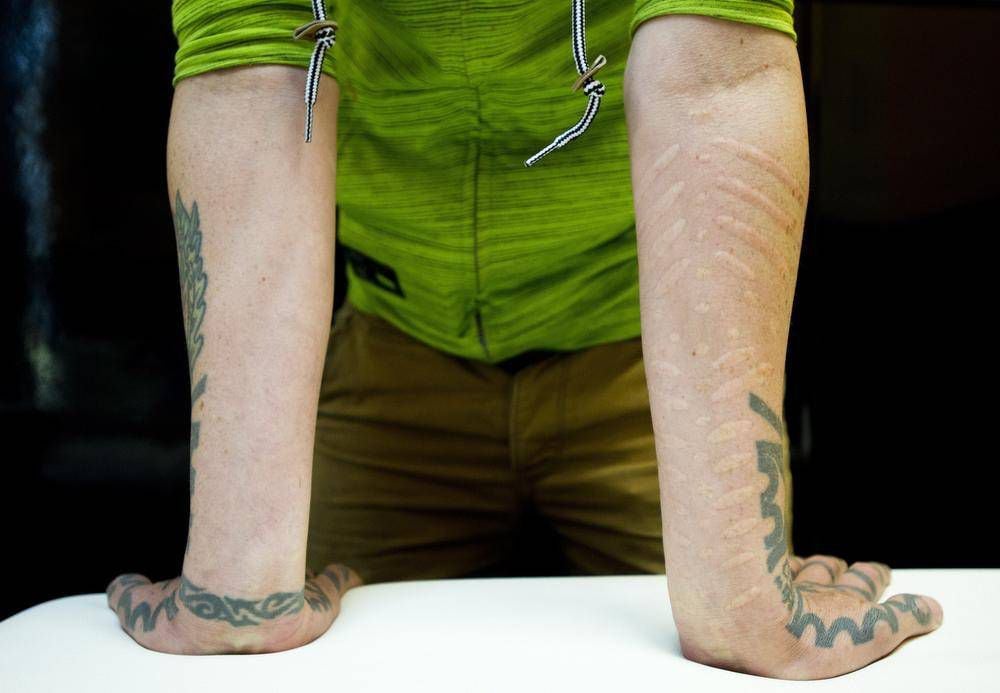 Scarification: The extreme body art that's making a mark - The Globe and  Mail