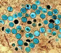 A colourized transmission electron micrograph of monkeypox particles (teal) found within an infected cell (brown), is shown in a handout photo captured at the NIAID Integrated Research Facility (IRF) in Fort Detrick, Maryland. THE CANADIAN PRESS/HO-National Institute of Allergy and Infectious Diseases **MANDATORY CREDIT**