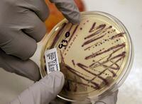 A microbiologist points out an isolated E. coli growth on an agar plate from a patient specimen at the Washington State Dept. of Health on Tuesday, Nov. 3, 2015, in Shoreline, Wash. A Calgary-based lawyer says she's preparing to file a class-action lawsuit following an E. coli outbreak linked to 11 daycares in the city.THE CANADIAN PRESS/AP-Elaine Thompson