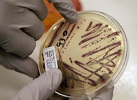 A microbiologist points out an isolated E. coli growth on an agar plate from a patient specimen at the Washington State Dept. of Health Tuesday, Nov. 3, 2015, in Shoreline, Wash. An official for six Calgary daycares closed due to an E. coli outbreak says a deep cleaning of the facilities could take anywhere from two days to a week. THE CANADIAN PRESS/AP-Elaine Thompson