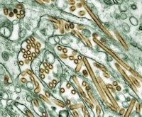 Colorized transmission electron micrograph of Avian influenza A H5N1 viruses (seen in gold) grown in MDCK cells (seen in green) as shown in this undated handout photo. The Canadian Food Inspection Agency says a domestic dog has been infected with H5N1 avian flu for the first time in Canada. THE CANADIAN PRESS/HO-CDC/Cynthia Goldsmith via NIH *MANDATORY CREDIT*