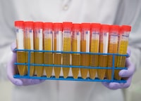 Plasma samples in a rack, before being put into a centrifuge at the LifeLabs Toronto facility, on Nov 22 2017. A new generation of simple blood tests is allowing would-be parents to learn about the sex and potential genetic anomalies of their babies in the first trimester, a stage of the pregnancy when it's relatively easy to get an abortion in Canada. Known as non-invasive prenatal testing (NIPT), the approach has the advantage of giving some women more time to make decisions about their pregnancies, while helping others to avoid unnecessary invasive procedures such as amniocentesis, which carry a small risk of miscarriage. (Fred Lum/The Globe and Mail) 