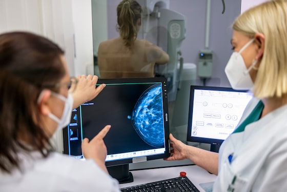 Ontario to lower age for mammograms to 40 from 50 next year