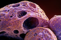 More people died in Canada in 2021 than the previous year, with cancer, heart disease, overdoses and COVID-19 cited as the leading causes of death. This colourized electron microscope image made available by the National Institute of Allergy and Infectious Diseases in November 2022, shows cells, indicated in purple, infected with the omicron strain of the SARS-CoV-2 virus, orange, isolated from a patient sample, captured at the NIAID Integrated Research Facility (IRF) in Fort Detrick, Md. THE CANADIAN PRESS/AP-HO, NIAID/NIH, *MANDATORY CREDIT*