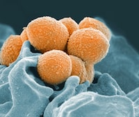 A bulletin released by the BC Centre for Disease Control, the Provincial Health Services Authority and the BC Children's Hospital says data from 2023 show a three-fold increase in invasive group A streptococcal infections in people under 20. An electron microscope image shows Group A Streptococcus in orange. THE CANADIAN PRESS/AP-NIAID via AP