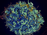 FILE - This electron microscope image made available by the U.S. National Institutes of Health shows a human T cell, in blue, under attack by HIV, in yellow, the virus that causes AIDS. Three women who were diagnosed with HIV after getting “vampire facial” procedures at an unlicensed New Mexico medical spa are the first believed to have contracted the virus through a cosmetic procedure using needles, according to federal health officials. (Seth Pincus, Elizabeth Fischer, Austin Athman/National Institute of Allergy and Infectious Diseases/NIH via AP, File)